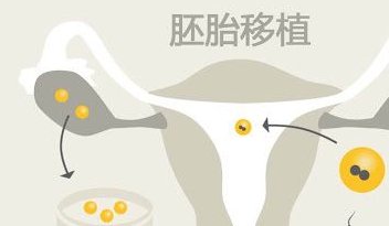 2026年拉拉去海军特色医学中心做三代试管详细费用价目表介绍